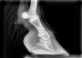 Rotated pedal bone in a pony with laminitis